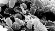 Analizirani ostaci lovaca-sakupljača iz Sibira: Kuga izazivala smrtonosne epidemije i pre 5.500 godina