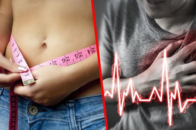 dijeta mrsavljenje, Srcani udar, infarkt. srce, pritisak, bol u grudima, ekg