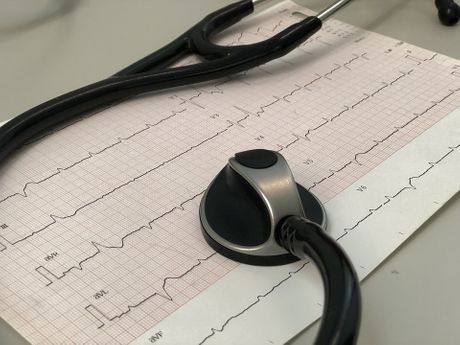 EKG, lekar, pregled, srce, doktor, lek, analize