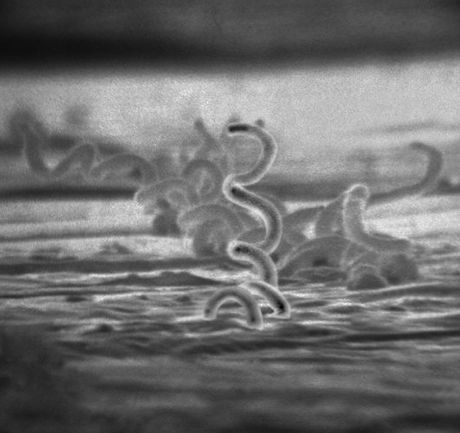 Treponema pallidum, Sifilis