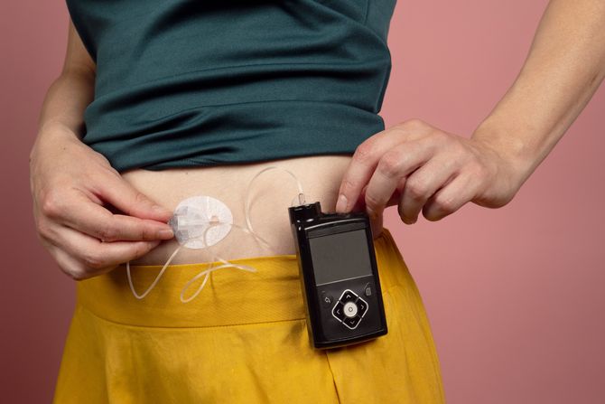 Dijabetes, aparat, senzor