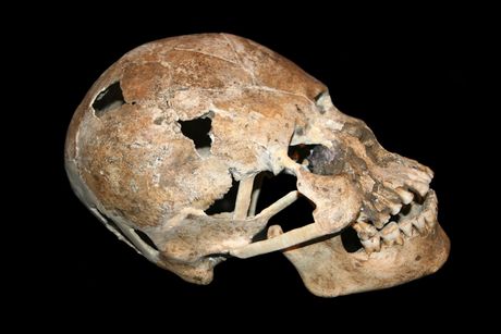 Produžena lobanja sa Kostarike