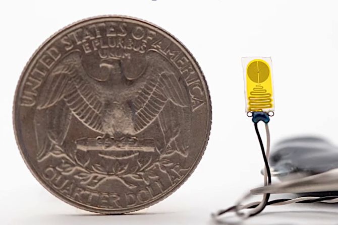 Uređaj, transplantacija