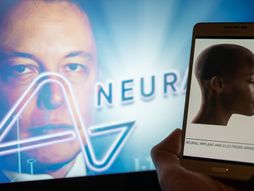 Ilon Mask, Neuralink, testiranje, čipovi