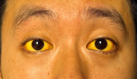 30 bolesti koje životinje prenose ljudima