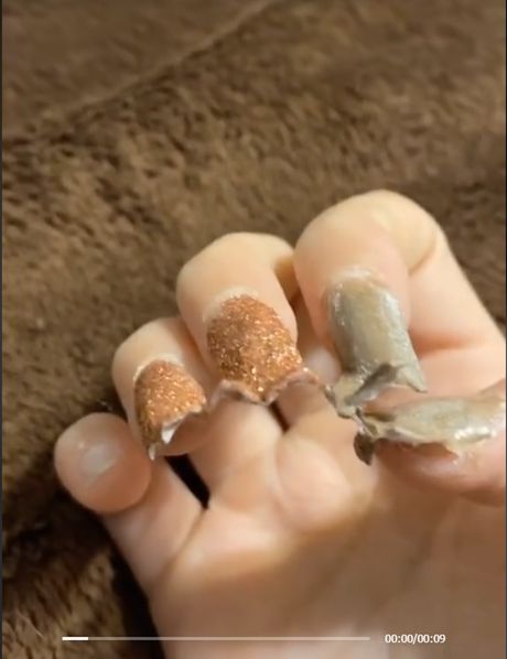 Pas izgrickao nokte vlasnici