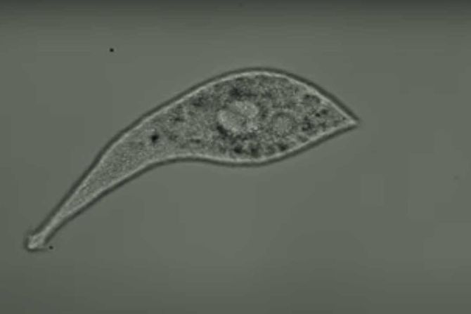protist Lacrymaria olor