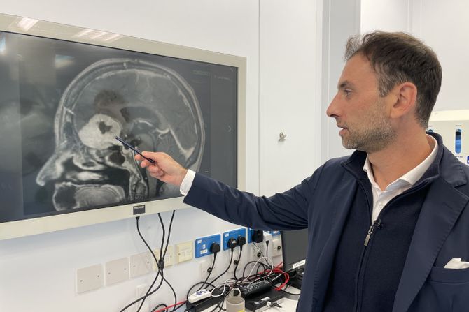 Operacija tumora, obrve, mozak