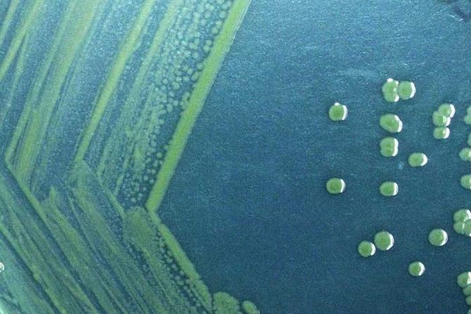 bakterija Shigella sonnei