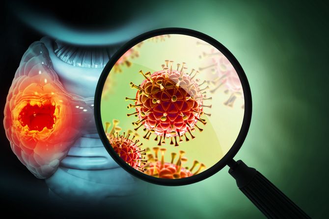 Rak štitne žlezde, štitna žlezda rak