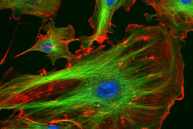 ćelijska fluorescencija