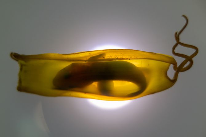 Nerođena beba ajkula