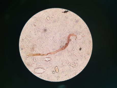 Okrugli crv u izmetu psa