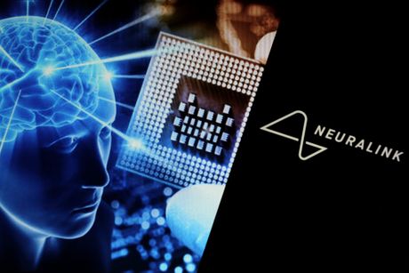 Neuralink