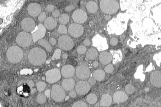 ćelijsko čišćenje