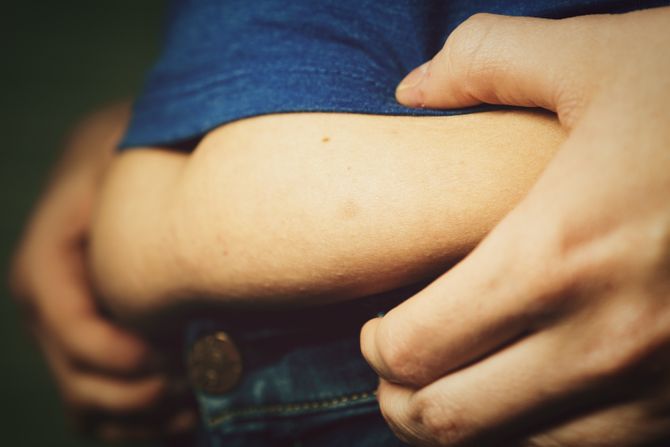 Visceralna masnoća, mast, gojaznost