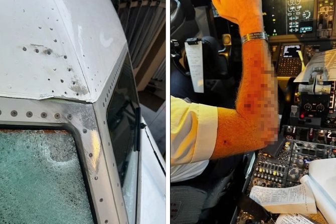 United Airlines 737 MAX, pilot povredjen, sofersajbna