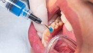 Ovo je prava revolucija u lečenju zuba: Napravljen gel koji može da izvede nezamislivo