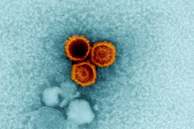 Epštajn-Barov virus