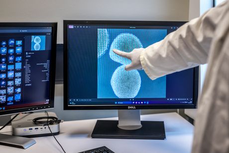 Naučnici uzgajaju mini ljudske mozgove za napajanje računara