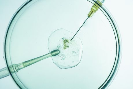 Jajna ćelija vantelesna oplodnja