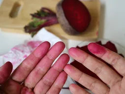 cvekla, crveni prsti