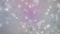 Revolucionarni medicinski poduhvat: Muškarac proizveo spermatozoide iz tkiva zamrznutog kad je bio dete