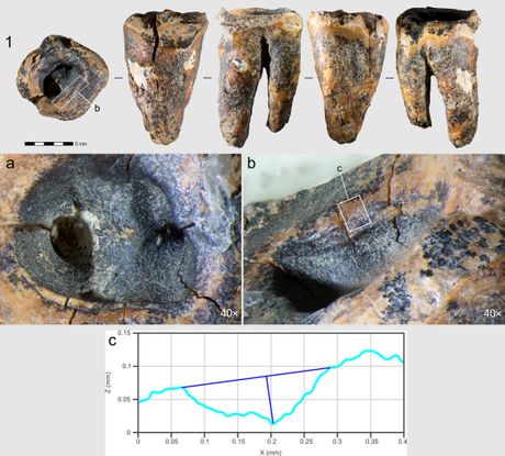 Izbušeni zub neandertalca